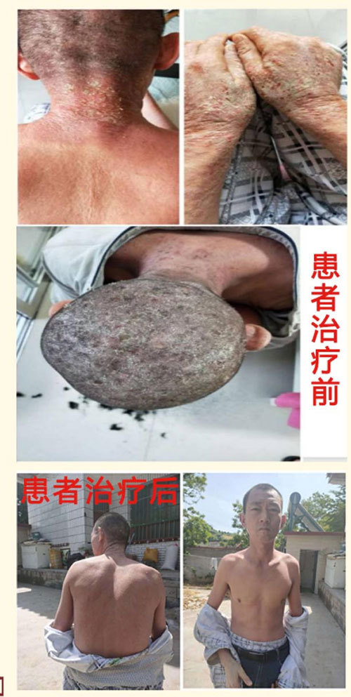 中国当代名中医 疑难杂症专家 —— 王森財