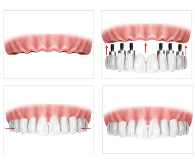 1759630902169492.png 图片12124.png