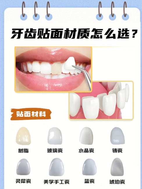 1760579167342634.png 图片12.png